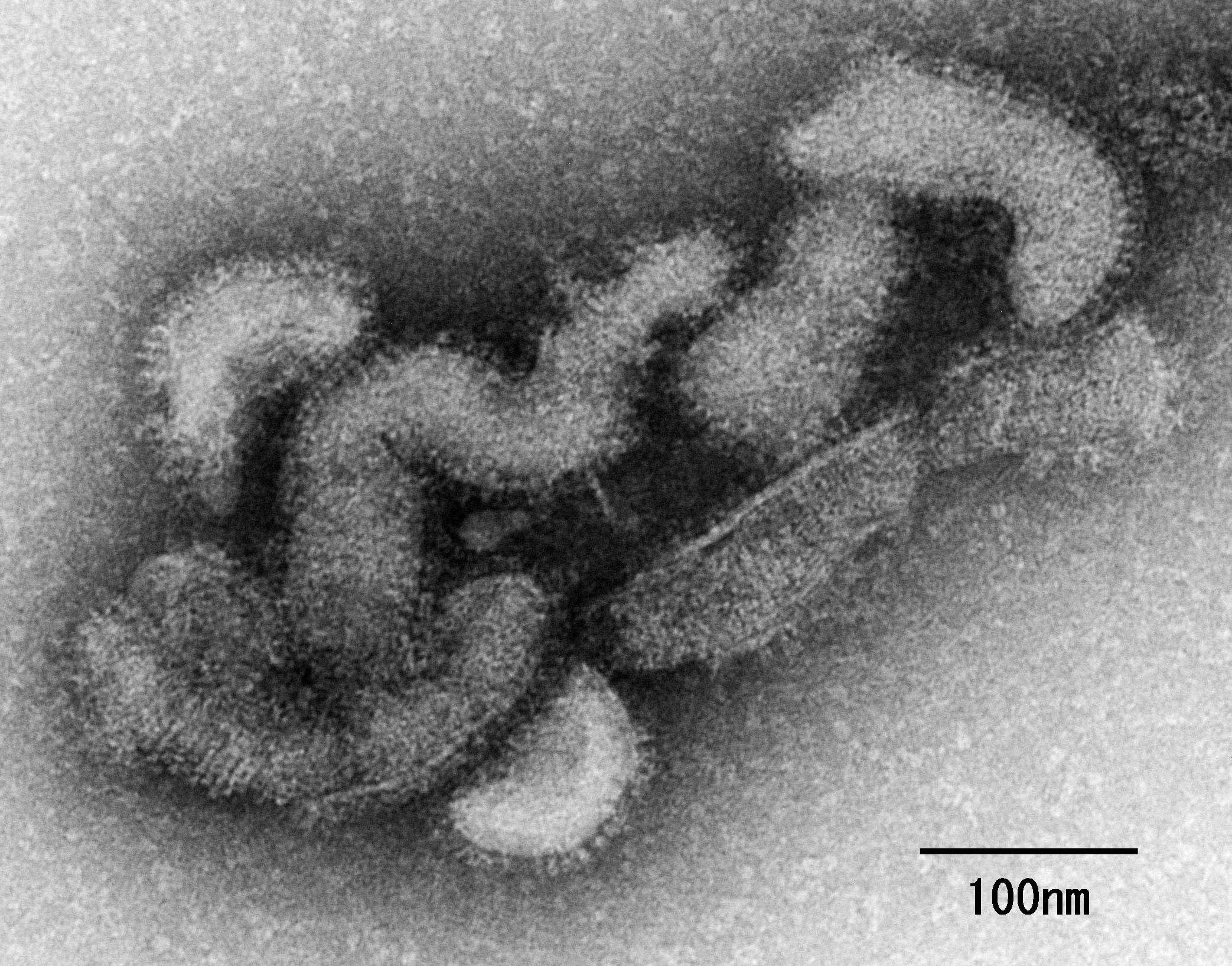 Electron micrograph of Oz virus particles