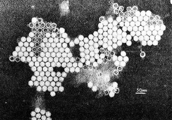 EV70 の電子顕微鏡像の画像