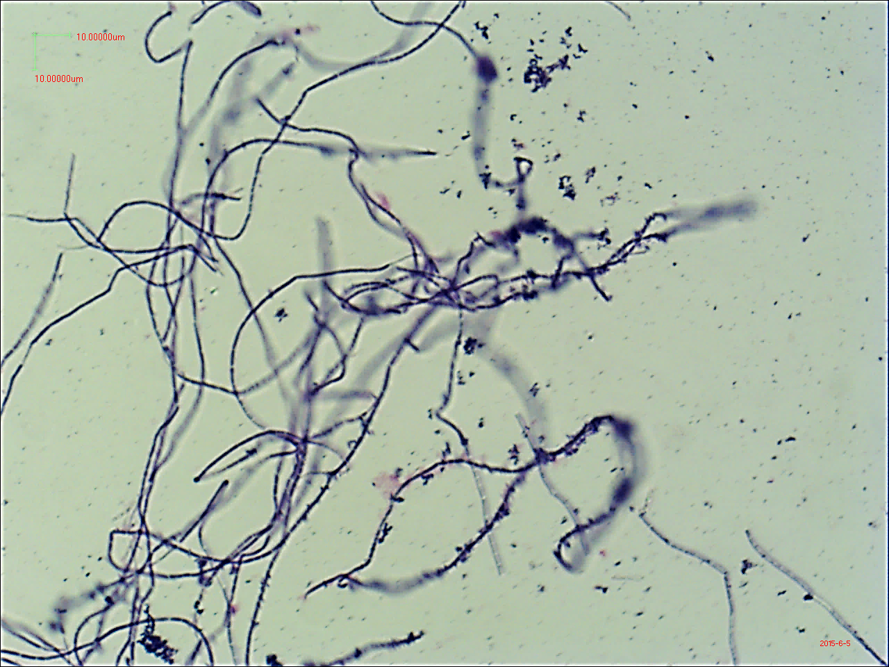 写真2：並列または絡み合った状態の断節的な竹節状の炭疽菌の長連鎖像（&times;400倍）の画像