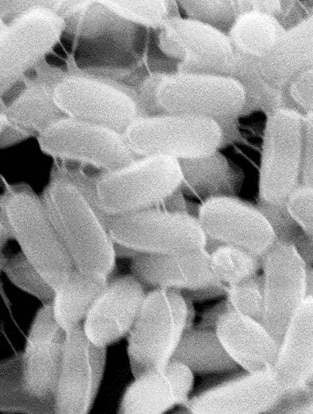 セレウス菌の電子顕微鏡像の画像