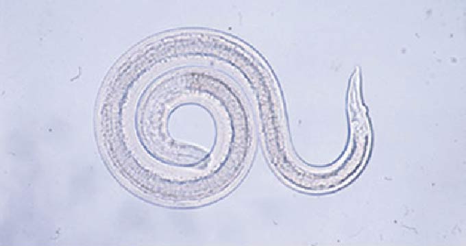 脳から回収された幼虫の画像