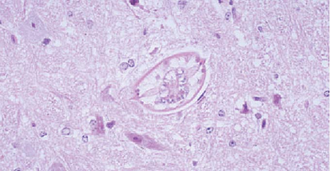 脳組織内の幼虫の画像