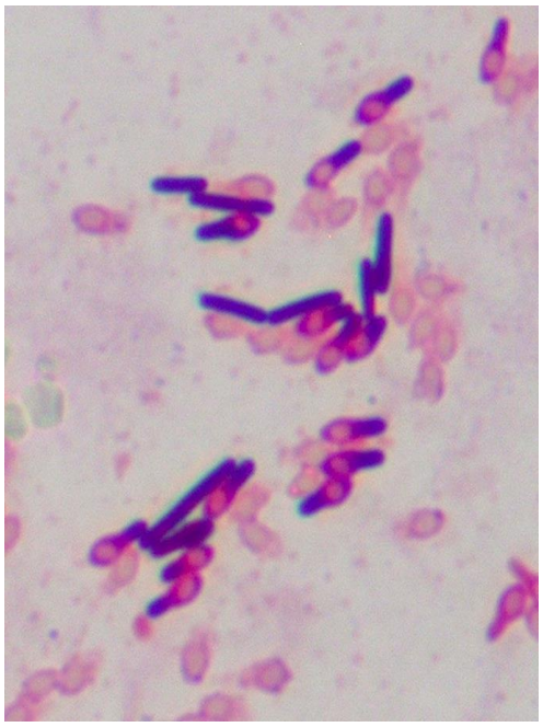 ボツリヌス菌のグラム染色顕微鏡写真。グラム陽性有芽胞桿菌