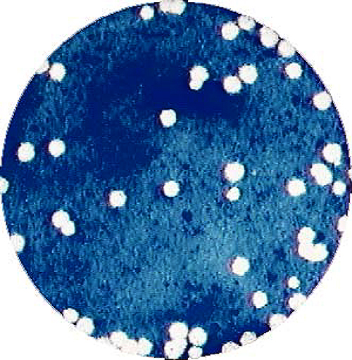 Vero細胞で形成されたチクングニアウイルスのプラークの画像