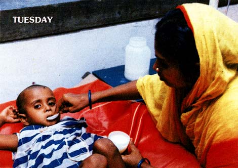 ORSを投与中の画像