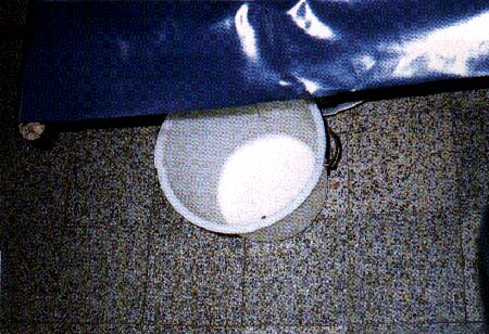 典型的な米のとぎ汁様の下痢便の画像