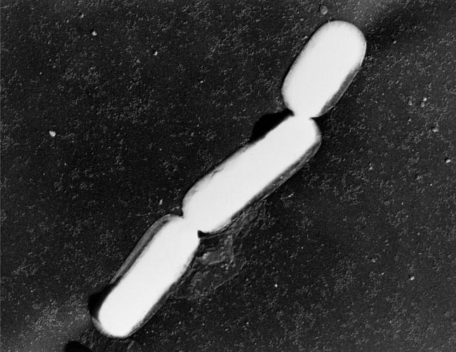ウエルシュ菌の電子顕微鏡写真。白色の桿菌が3つ連なった形態を示している。各菌体は楕円形で両端が丸く、くびれた部分で連結している。背景は黒く、コントラストが強い白黒画像。