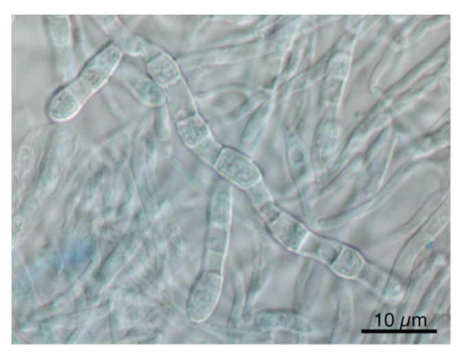 Coccidioides posadasiiの分節型分生子