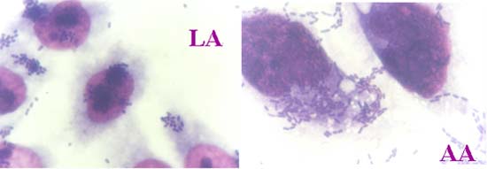限局型接着の画像