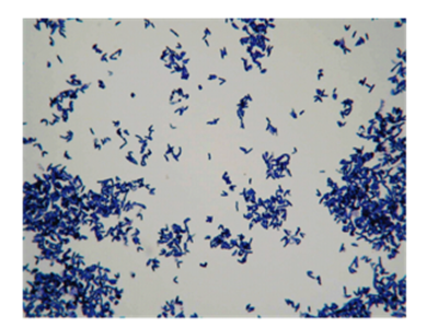 Corynebacterium diphtheriae（ジフテリア菌）のグラム染色所見通性嫌気性（好気性）グラム陽性桿菌の画像