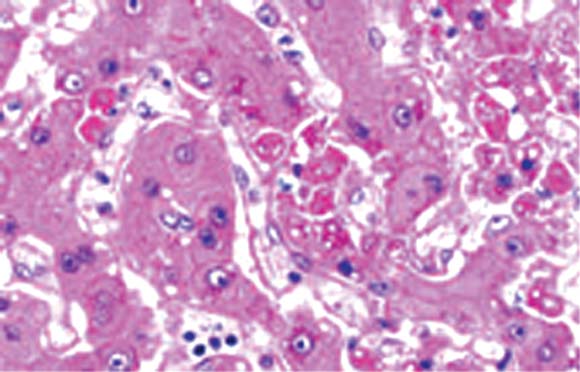 エボラウイルス実験感染サルの肝臓