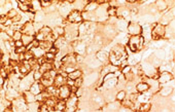 免疫染色による肝臓の病理組織