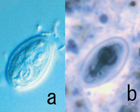 Giardia lambliaの嚢子の画像