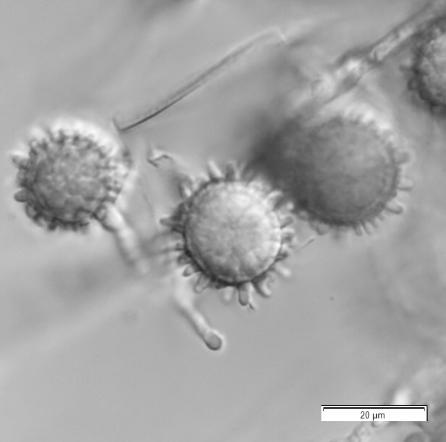 図1：H. capsulatumの大分生子の画像