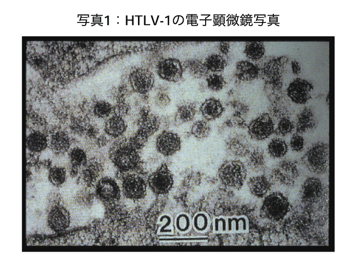 HTLV-1の電子顕微鏡写真の画像