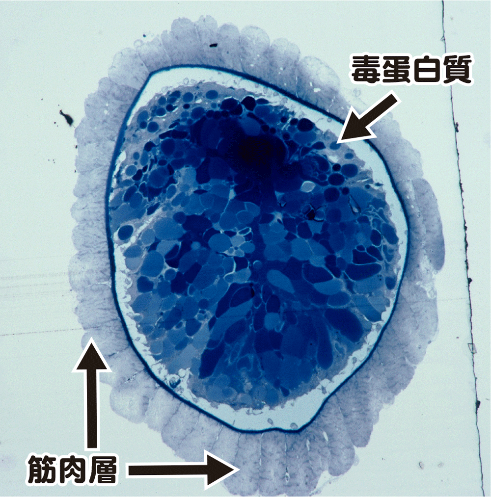 セアカゴケグモ毒腺の微細構造の画像