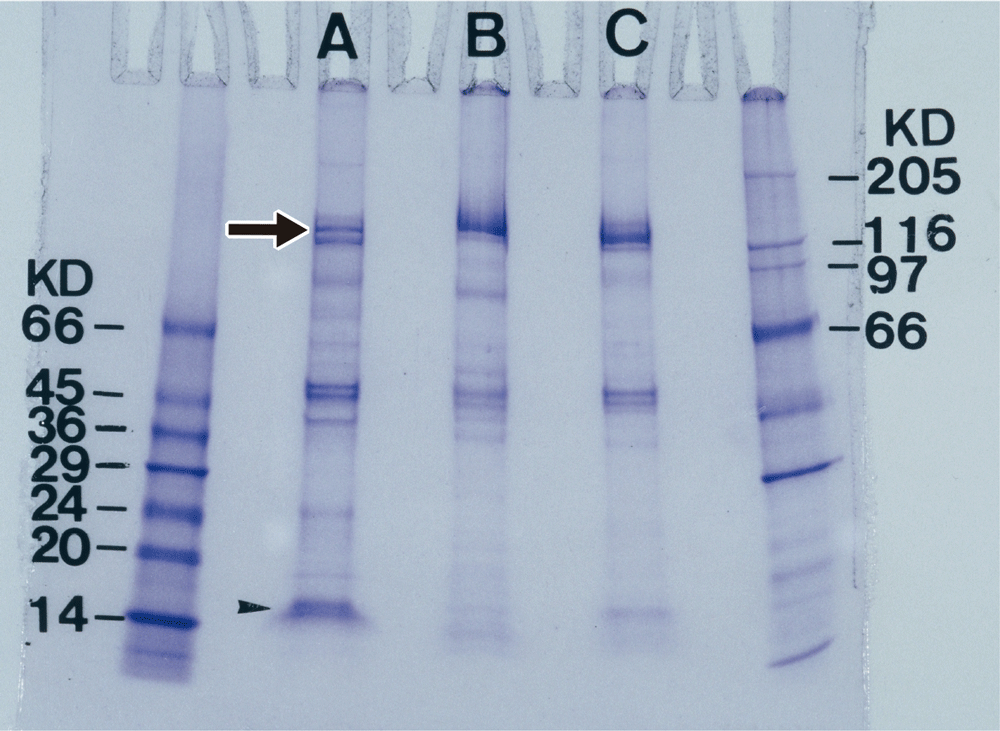 3種ゴケグモの毒腺抽出物のSDS電気泳動パターンの画像