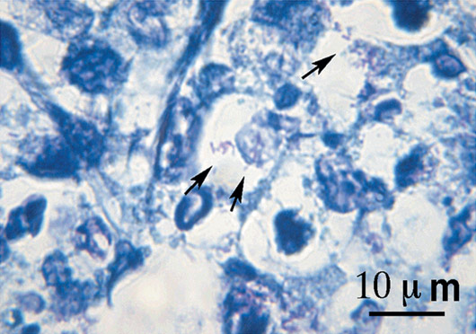 肺切片のヒメネス染色像の画像