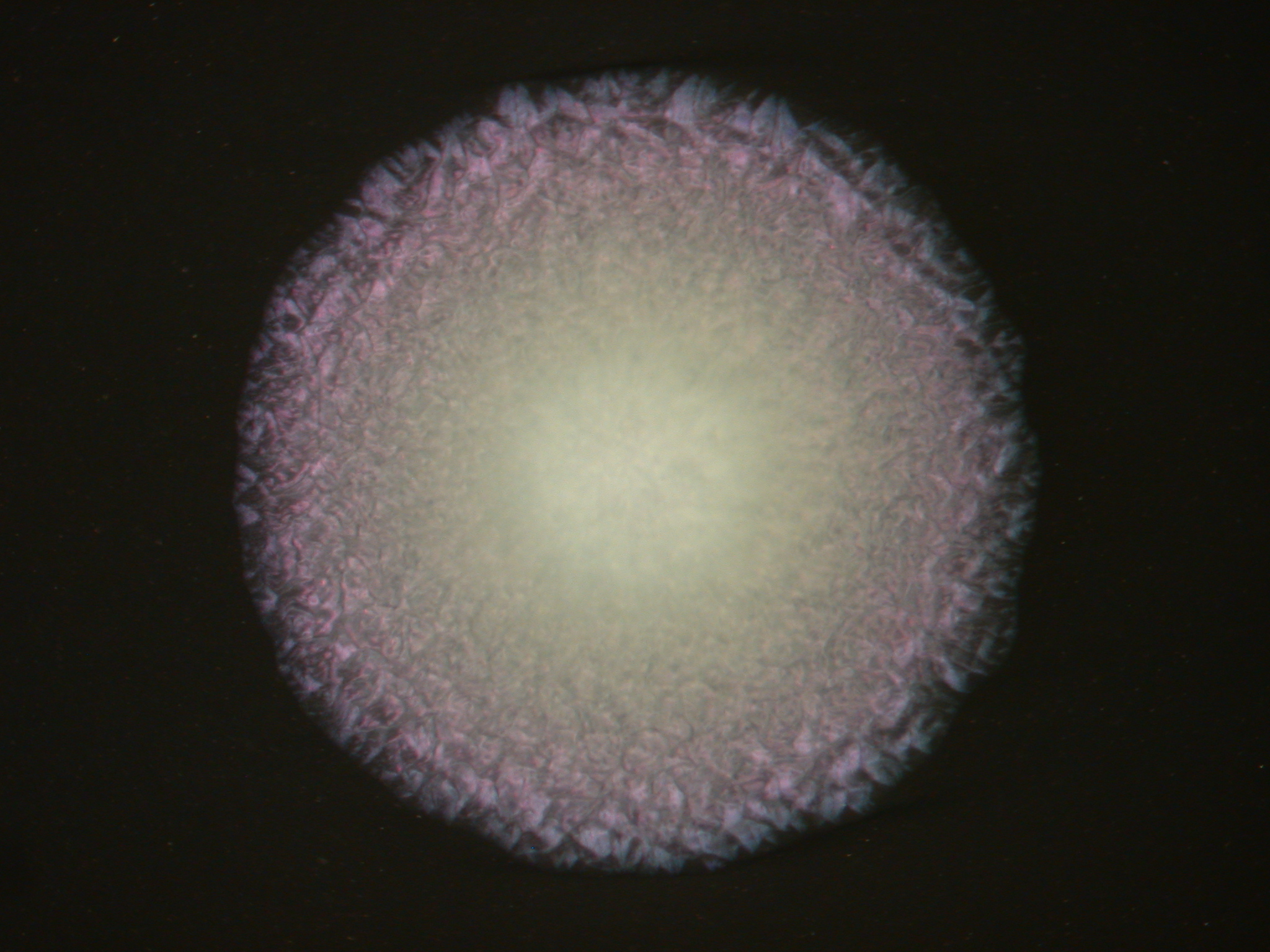 レジオネラ・ニューモフィラのコロニー外観の画像