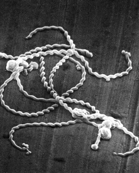 病原性レプトスピラの電子顕微鏡像の画像