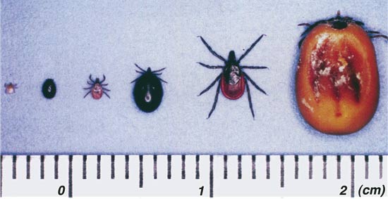 シュルツェ・マダニの画像