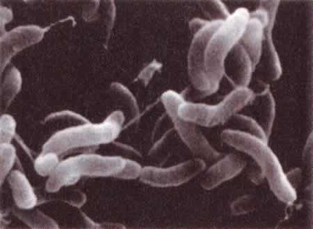 ナグビブリオ（NAG）の走査電子顕微鏡像の画像