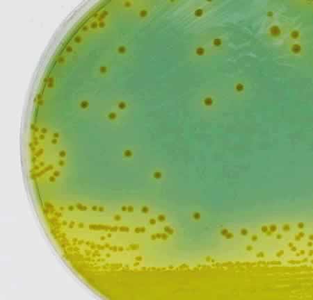 TCBS培地上のナグビブリオの画像