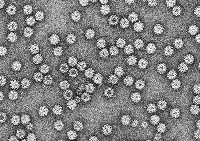 組換えバキュロウイルスで作製したVLPの電子顕微鏡像の画像