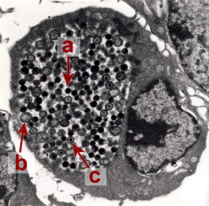 オウム病クラミジアの電顕像の画像