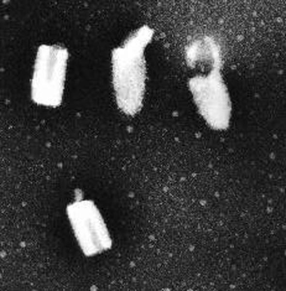 狂犬病ウイルスの電子顕微鏡写真の画像