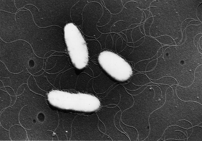 Salmonella Enteritidisの電子顕微鏡写真の画像