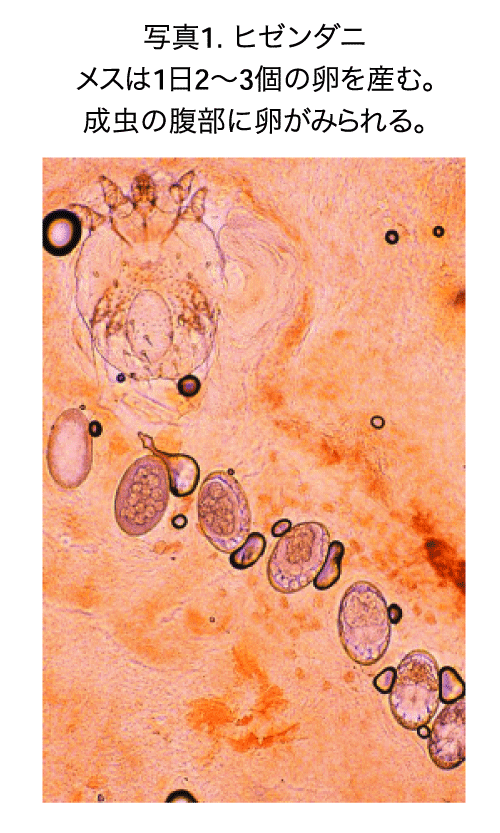 写真1．ヒゼンダニの画像