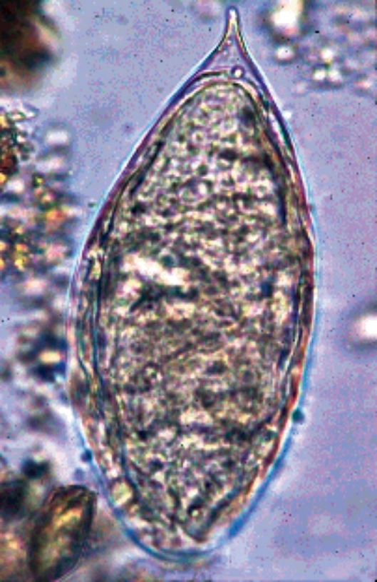 ビルハルツ住血吸虫の画像