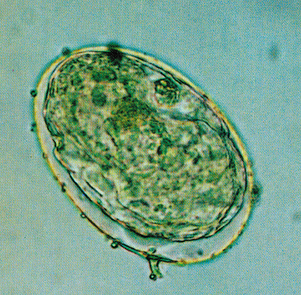 日本住血吸虫の画像