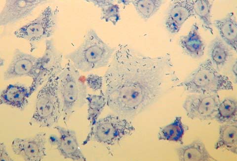 培養HeLa細胞における赤痢菌（Shigella flexneri）の感染過程を示す顕微鏡写真。青紫色に染色された宿主細胞（HeLa細胞）の中に、赤痢菌が侵入・増殖している様子が観察される。細胞質内で増殖した菌体の一部は隣接する細胞へと移行しようとしている。背景は淡い黄色で、細胞と菌体のコントラストが明瞭。