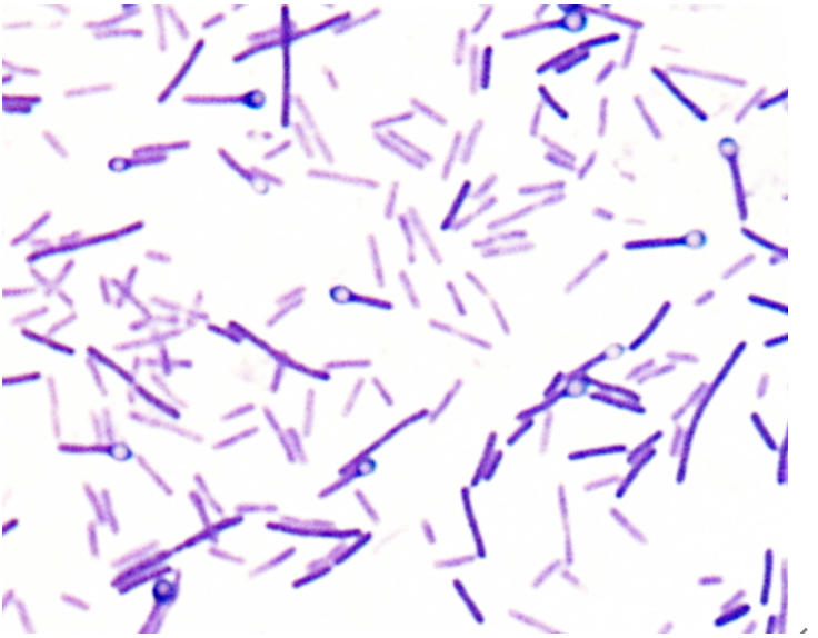 Clostridium tetani (破傷風菌)のグラム染色所見の画像