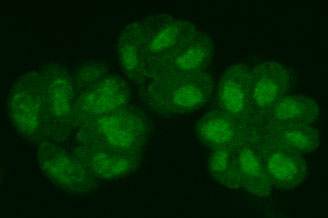 トキソプラズマの画像