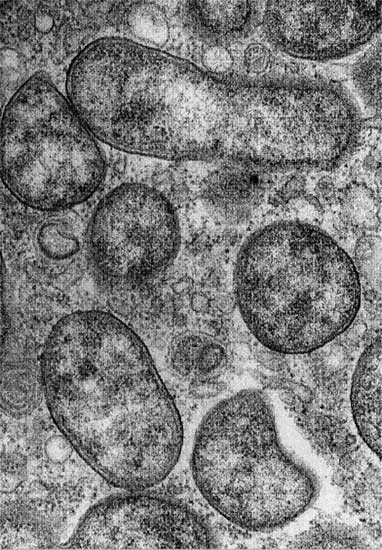 Orientia tsutsugamushiの電子顕微鏡写真の画像