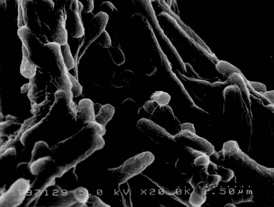 電子顕微鏡で撮影された結核菌の写真。ハンセン病研究センターによって撮影。細長い棒状の菌体が多数観察され、菌体同士が絡み合うように存在している。黒い背景に対して白く浮かび上がる菌体が明瞭に観察できる。