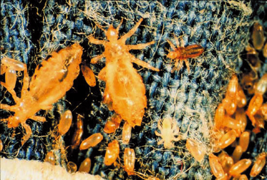 コロモジラミの生体写真。青い布の繊維の上に複数のコロモジラミが観察される。虫体は黄褐色で、扁平な体型を持ち、特徴的な節足動物の形態を示している。成虫と卵が混在して付着している様子が捉えられている