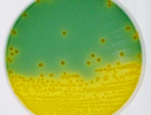 TCBS培地上のVibrio fluvialisのコロニー写真。培地の下半分は黄色く変色しており、上半分は緑色の背景に黄色い円形のコロニーが散在している。