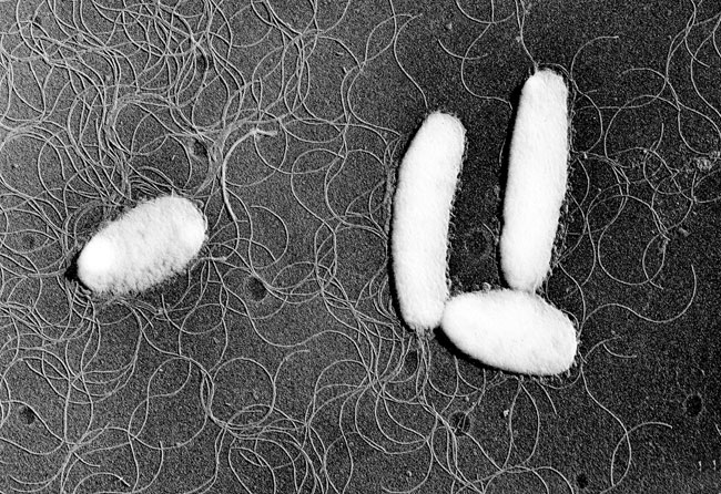 腸炎ビブリオの電子顕微鏡写真：周毛。単毛よりも波状が短く、細い。の画像