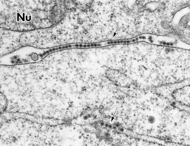 電子顕微鏡で撮影されたウエストナイルウイルスを示す白黒画像