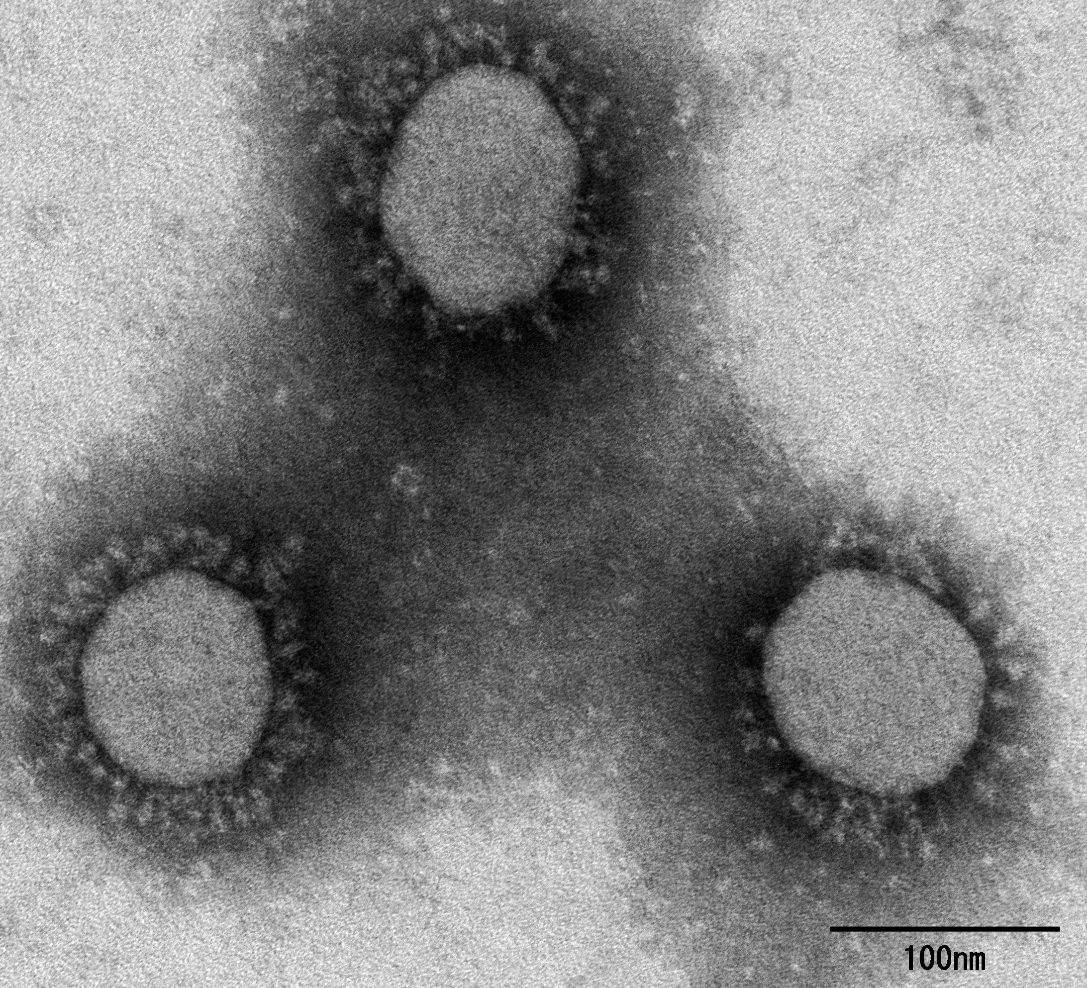 SARS-CoV-2 Variant of Concern, Lineage P.1の電子顕微鏡写真