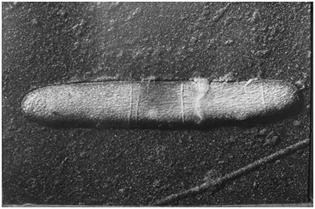 らい菌の電子顕微鏡写真