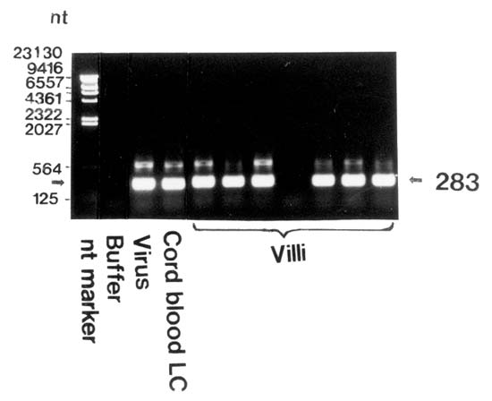 図4：風疹ウイルス遺伝子の検出の画像